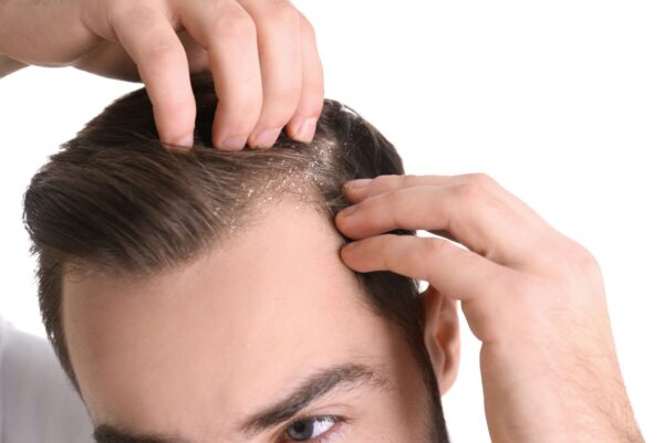 Dandruff(or) Hairfall Treatment for Men - Advance